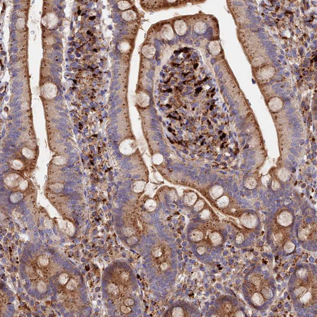 PPP2R3C Antibody in Immunohistochemistry (Paraffin) (IHC (P))