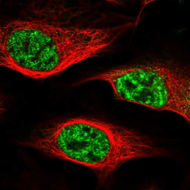 ZC3H18 Antibody in Immunocytochemistry (ICC/IF)