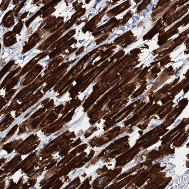 ELAC1 Antibody in Immunohistochemistry (Paraffin) (IHC (P))