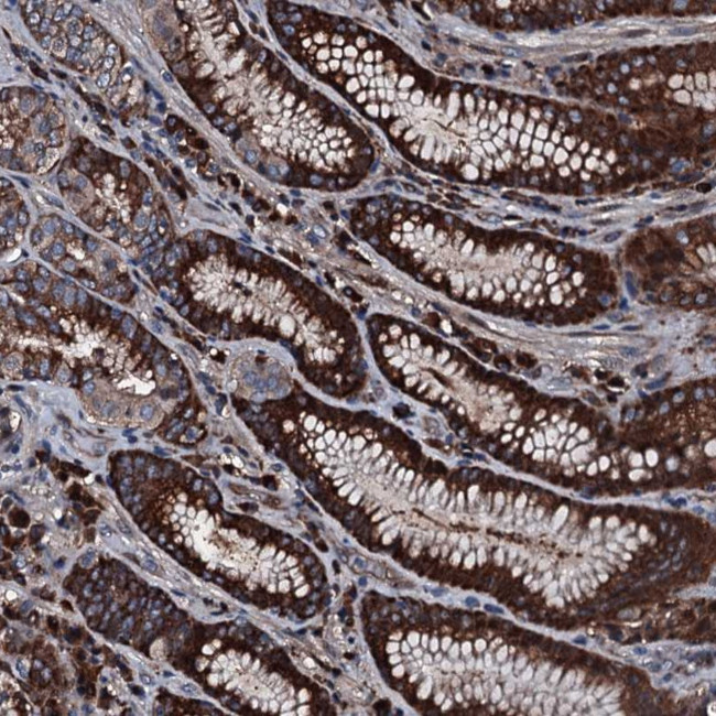 alanyl-tRNA Synthetase Antibody in Immunohistochemistry (Paraffin) (IHC (P))