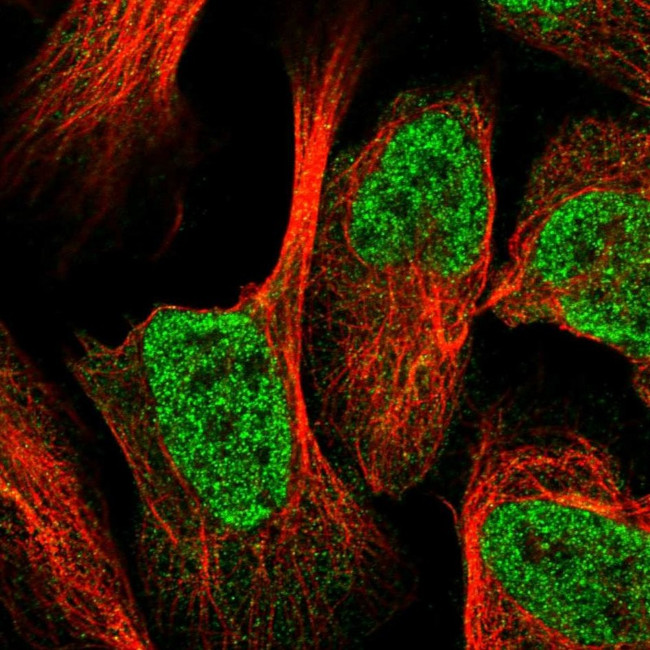 eIF6 Antibody in Immunocytochemistry (ICC/IF)