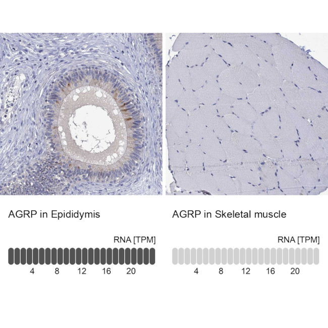 AgRP Antibody in Immunohistochemistry (Paraffin) (IHC (P))