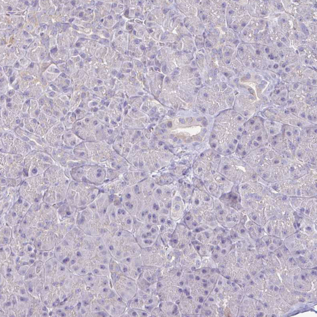 IL18BP Antibody in Immunohistochemistry (Paraffin) (IHC (P))