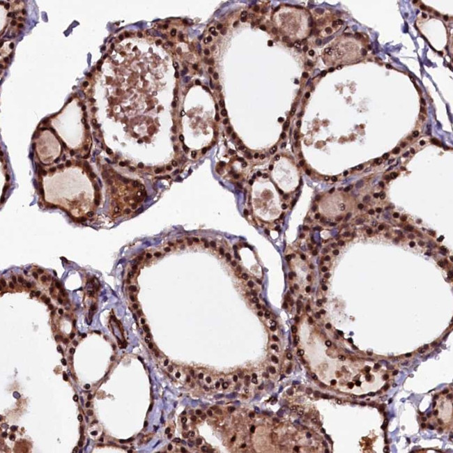 N4BP1 Antibody in Immunohistochemistry (Paraffin) (IHC (P))