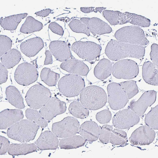 PLA2G4E Antibody in Immunohistochemistry (Paraffin) (IHC (P))