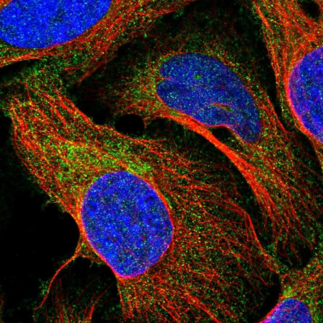 CTU2 Antibody in Immunocytochemistry (ICC/IF)