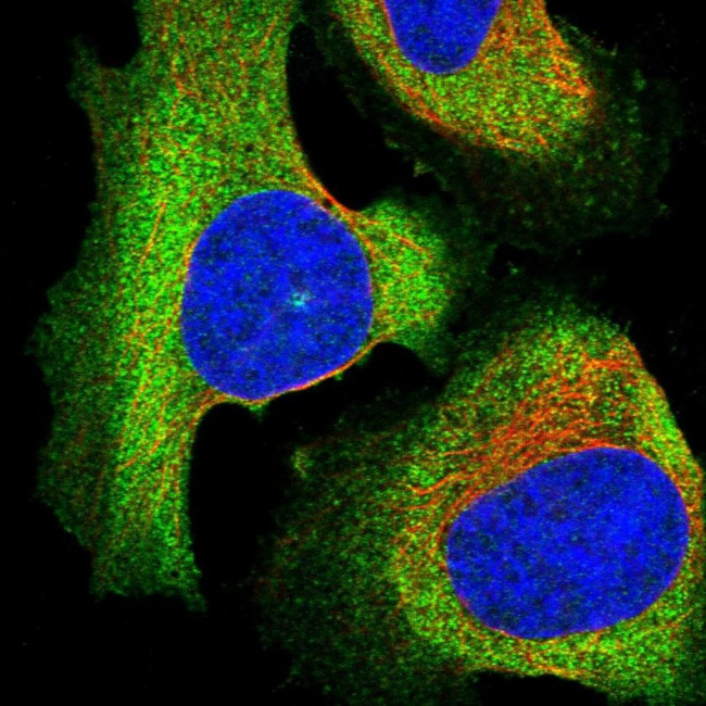 EPS8L2 Antibody in Immunocytochemistry (ICC/IF)