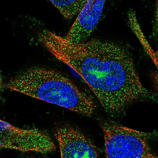 AMDHD2 Antibody in Immunocytochemistry (ICC/IF)