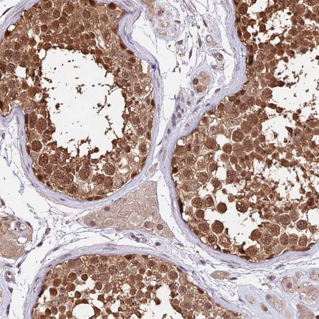 HERPUD1 Antibody in Immunohistochemistry (Paraffin) (IHC (P))