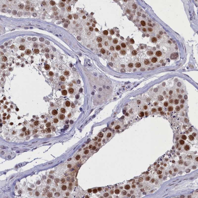 MCAF2 Antibody in Immunohistochemistry (Paraffin) (IHC (P))