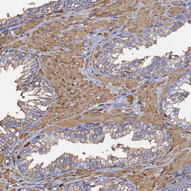 beta Actin Antibody in Immunohistochemistry (IHC)