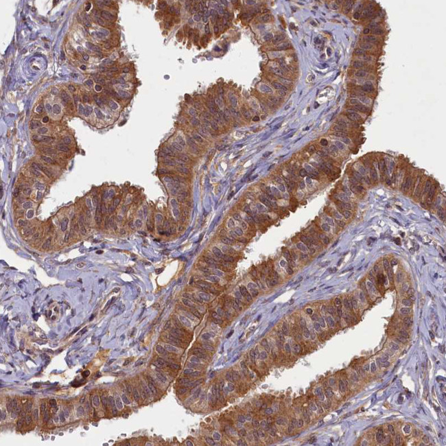 BICD1 Antibody in Immunohistochemistry (Paraffin) (IHC (P))