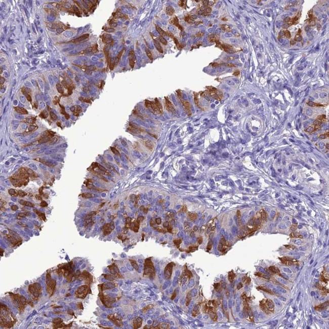 BBS2 Antibody in Immunohistochemistry (Paraffin) (IHC (P))