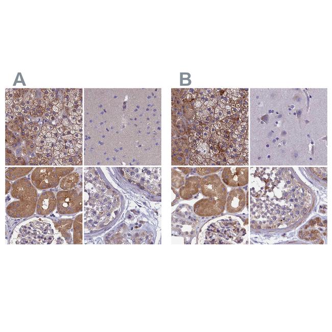 AMDHD2 Antibody in Immunohistochemistry (IHC)