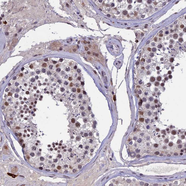 RNF40 Antibody in Immunohistochemistry (Paraffin) (IHC (P))