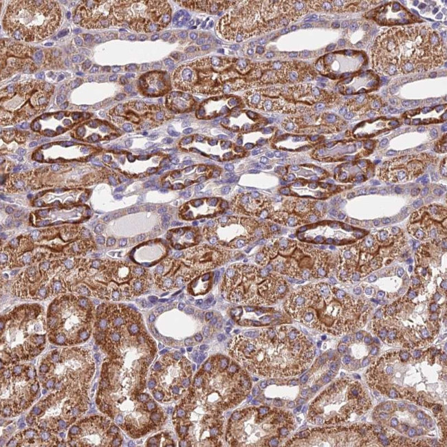 TRMT1 Antibody in Immunohistochemistry (Paraffin) (IHC (P))