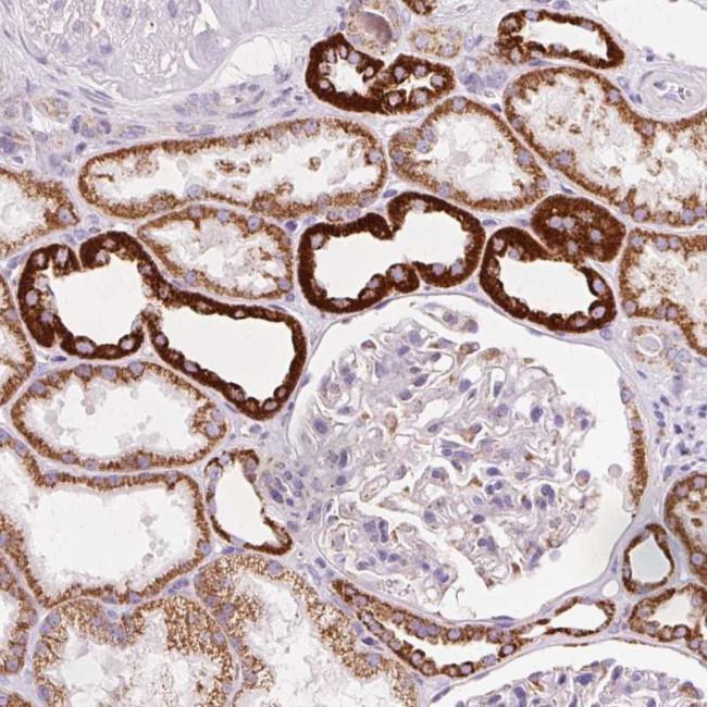 ATP Synthase O Antibody in Immunohistochemistry (Paraffin) (IHC (P))