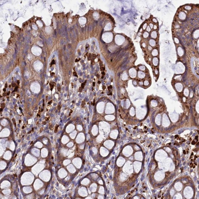 RLTPR Antibody in Immunohistochemistry (Paraffin) (IHC (P))