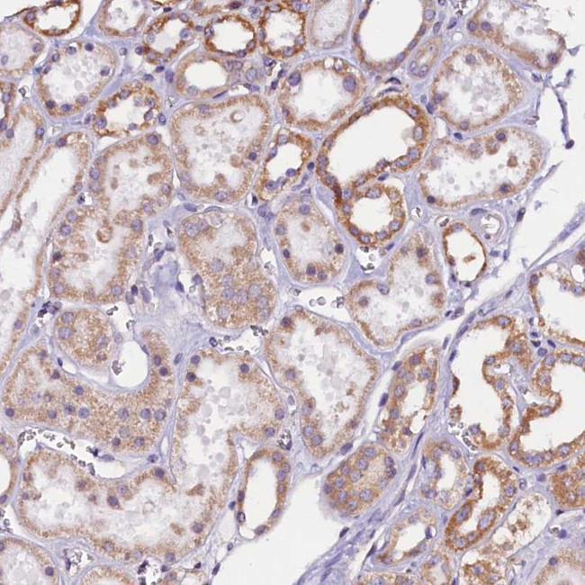 UACA Antibody in Immunohistochemistry (Paraffin) (IHC (P))