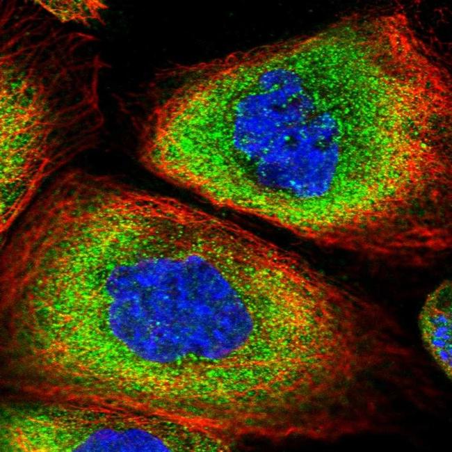 SNRPD2 Antibody in Immunocytochemistry (ICC/IF)