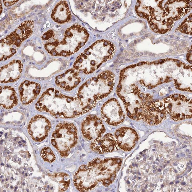 PAGR1 Antibody in Immunohistochemistry (Paraffin) (IHC (P))