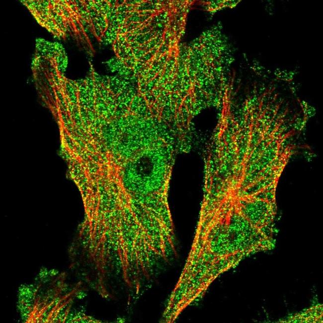 FAM96B Antibody in Immunocytochemistry (ICC/IF)