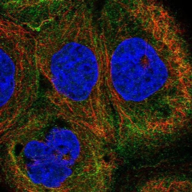 SLC1A6 Antibody in Immunocytochemistry (ICC/IF)