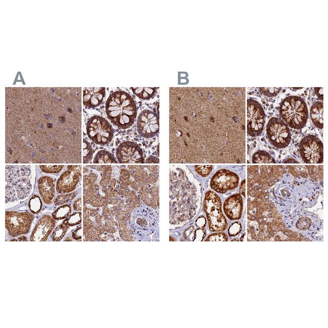 NDUFA8 Antibody in Immunohistochemistry (IHC)