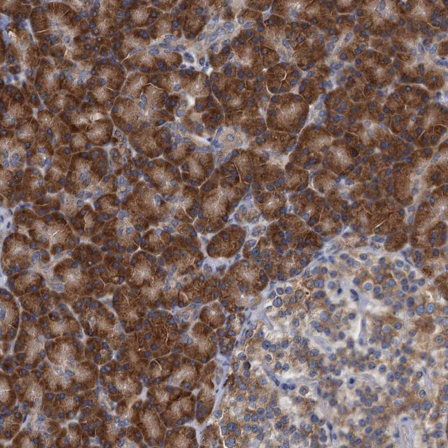 ALG2 Antibody in Immunohistochemistry (Paraffin) (IHC (P))