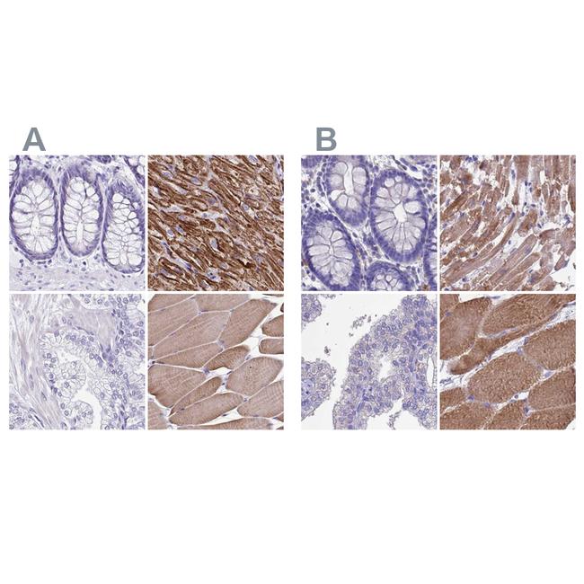 Sarcalumenin Antibody in Immunohistochemistry (IHC)