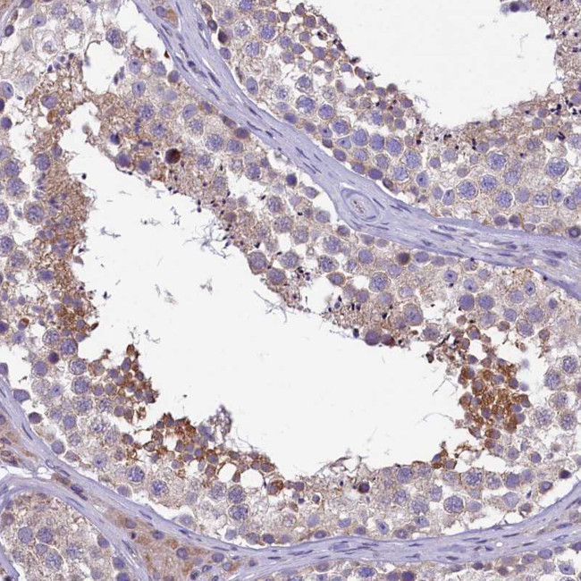 DNAJB9 Antibody in Immunohistochemistry (Paraffin) (IHC (P))