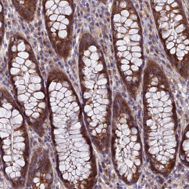 NSMCE1 Antibody in Immunohistochemistry (Paraffin) (IHC (P))