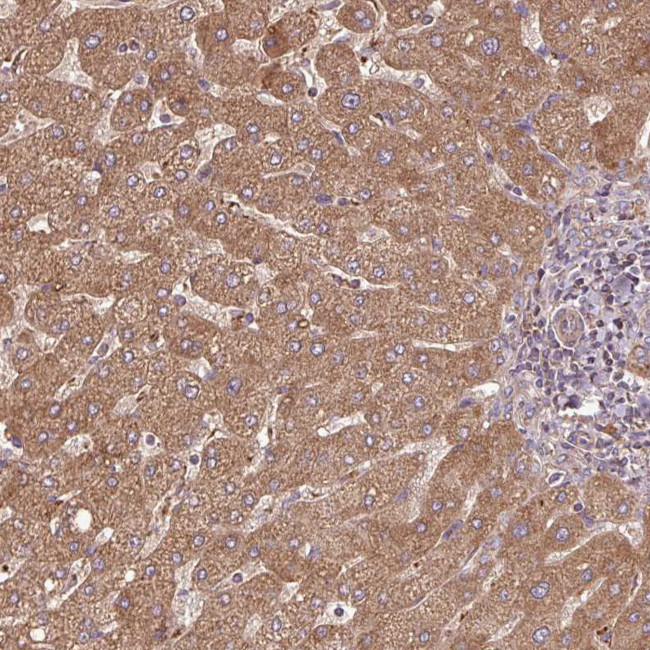 SQRDL Antibody in Immunohistochemistry (Paraffin) (IHC (P))