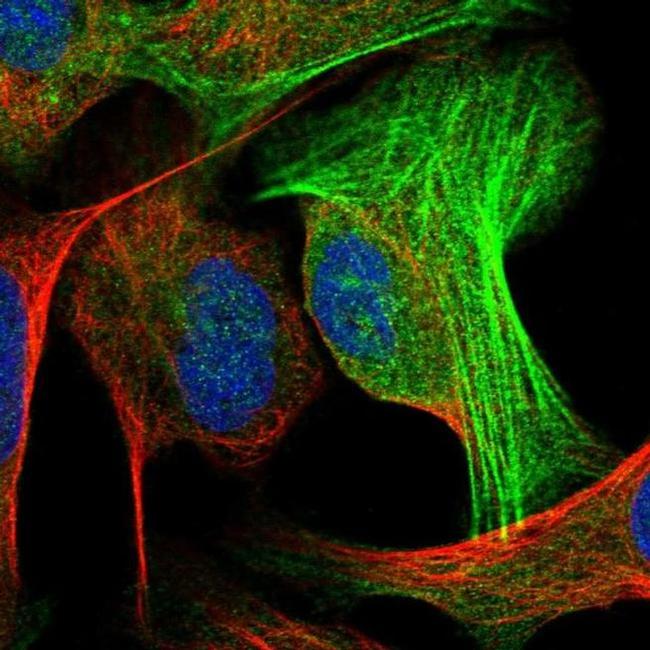 ALG2 Antibody in Immunocytochemistry (ICC/IF)