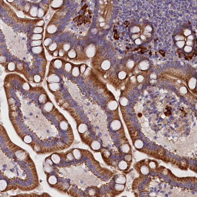 FRY Antibody in Immunohistochemistry (Paraffin) (IHC (P))