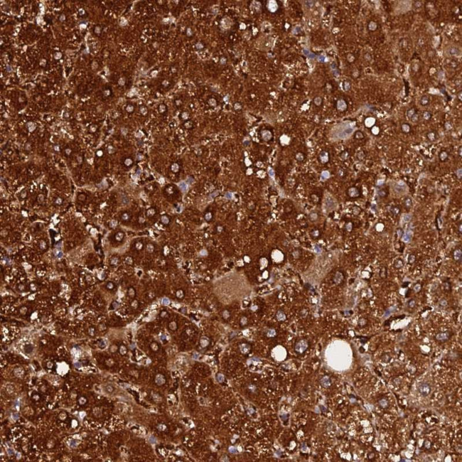 FAM118B Antibody in Immunohistochemistry (Paraffin) (IHC (P))