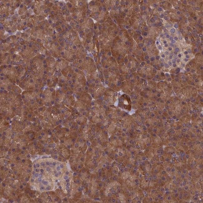 NUBP1 Antibody in Immunohistochemistry (IHC)