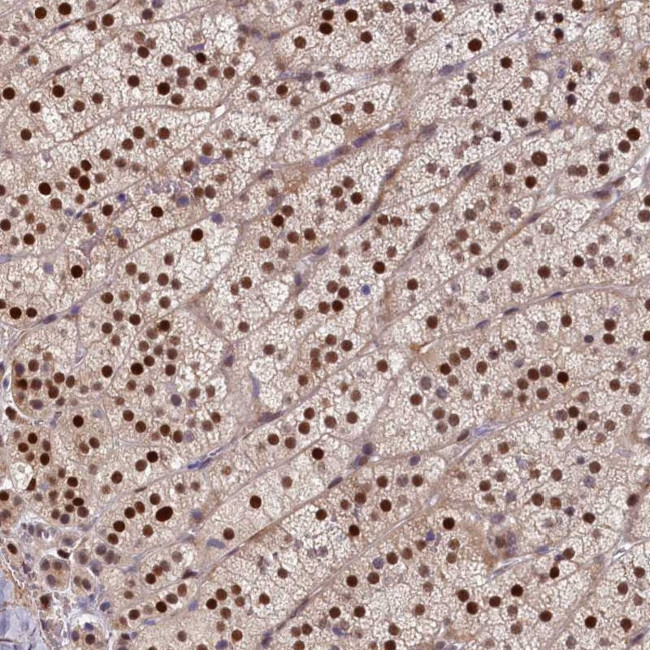 CHST12 Antibody in Immunohistochemistry (Paraffin) (IHC (P))