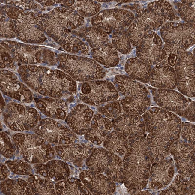 PCCA Antibody in Immunohistochemistry (Paraffin) (IHC (P))