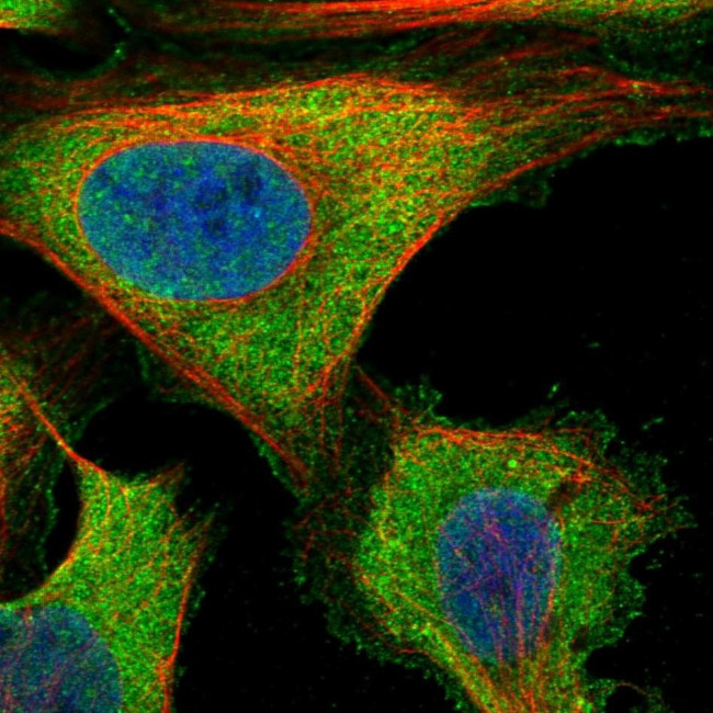 ZNF598 Antibody in Immunocytochemistry (ICC/IF)