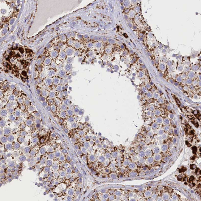 AKTIP Antibody in Immunohistochemistry (Paraffin) (IHC (P))