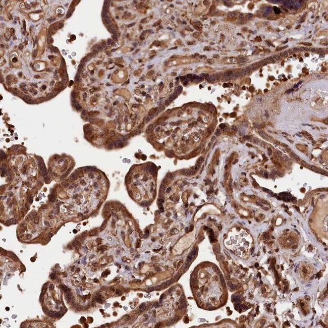 IST1 Antibody in Immunohistochemistry (IHC)