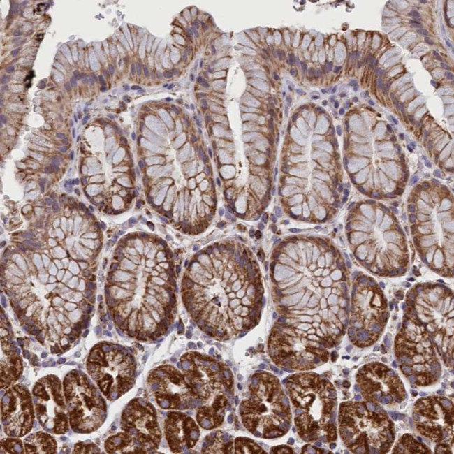 IFT122 Antibody in Immunohistochemistry (Paraffin) (IHC (P))