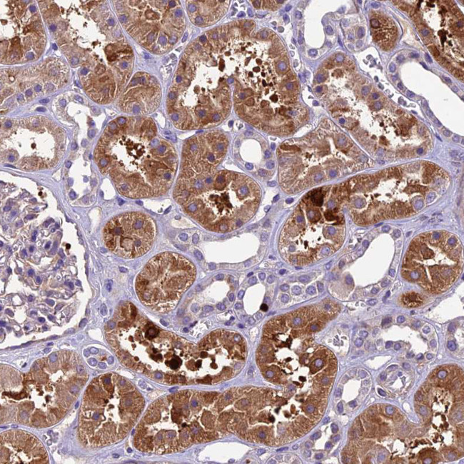 CILP2 Antibody in Immunohistochemistry (Paraffin) (IHC (P))