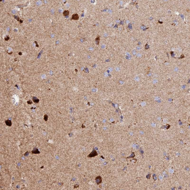 DUS3L Antibody in Immunohistochemistry (Paraffin) (IHC (P))