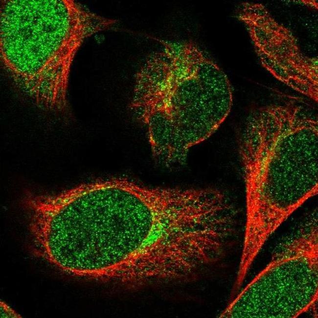 MVB12A Antibody in Immunocytochemistry (ICC/IF)