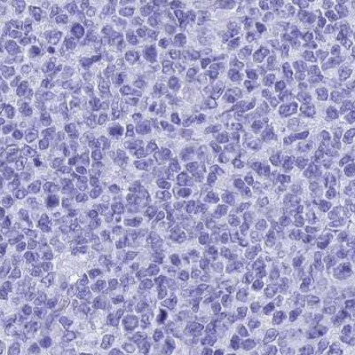 TEX101 Antibody in Immunohistochemistry (Paraffin) (IHC (P))