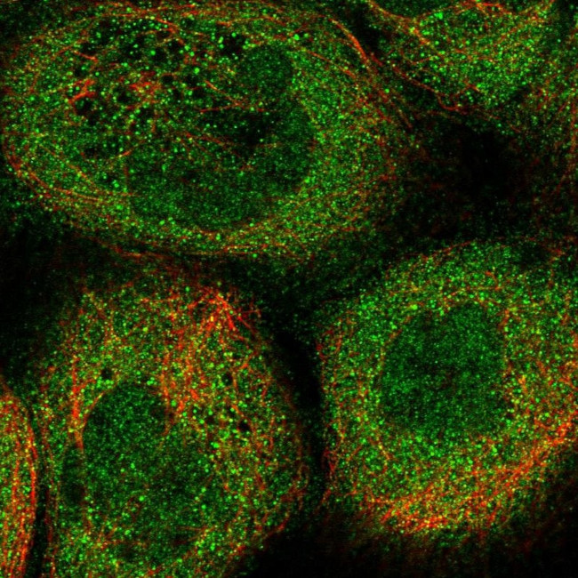 DOHH Antibody in Immunocytochemistry (ICC/IF)