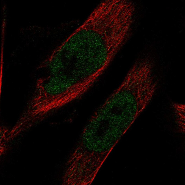 IMPACT Antibody in Immunocytochemistry (ICC/IF)