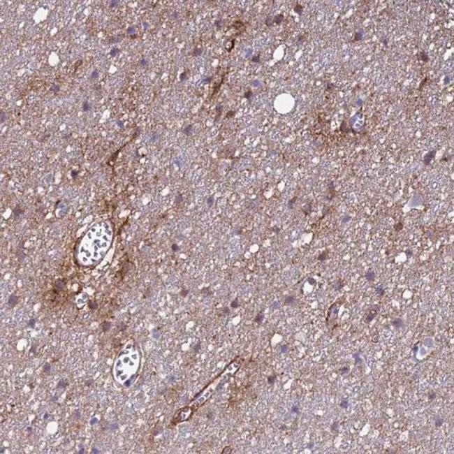 P2X7 Antibody in Immunohistochemistry (IHC)